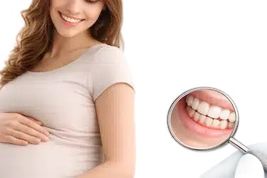 Inflamación de encías durante el embarazo por cambios hormonales