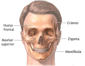 injerto hueso maxilar