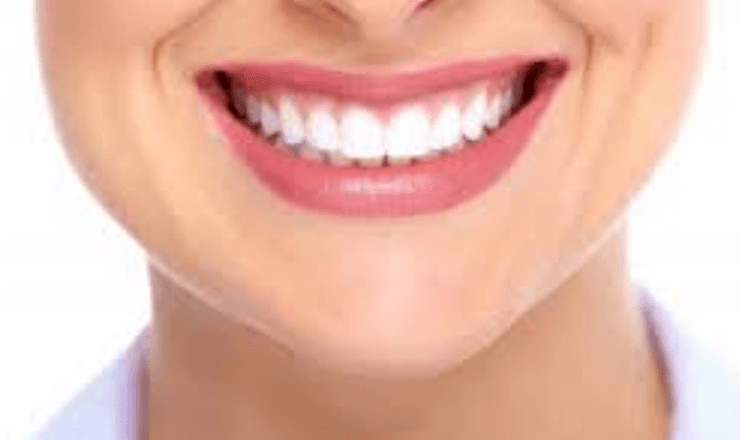  Dientes torcidos - Clínica dental Dr. Ferrer | Madrid