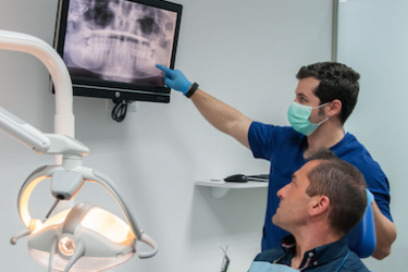 implantes dentales valoracion