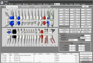 Plan de tratamiento implantes dentales