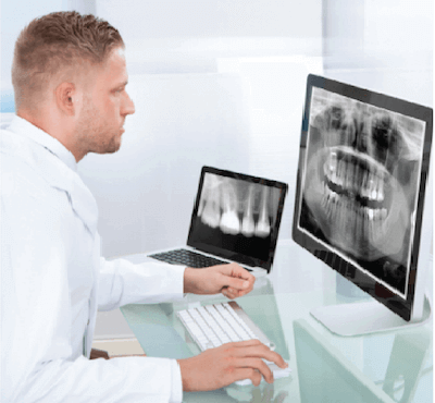  Radiografía dental panorámica - Clínica dental Dr. Ferrer | Madrid
