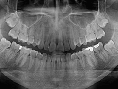 rayos x dental panoramica