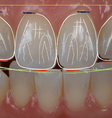  Especialistas en Estética dental en Madrid - Clínica dental Dr. Ferrer | Madrid