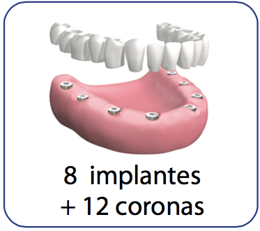 protesis dental con implantes y coronas de porcelana