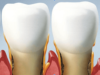 periodoncia