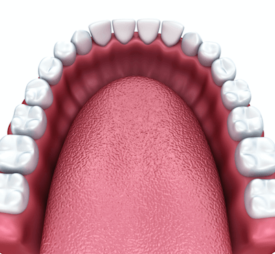  Prótesis dental con implantes - Clínica dental Dr. Ferrer | Madrid