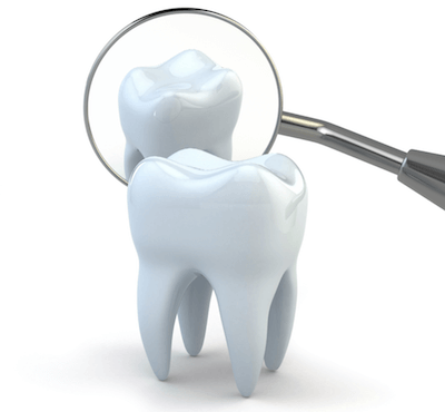  ¿Cuál es el precio de un curetaje dental por cuadrante? - Clínica dental Dr. Ferrer | Madrid