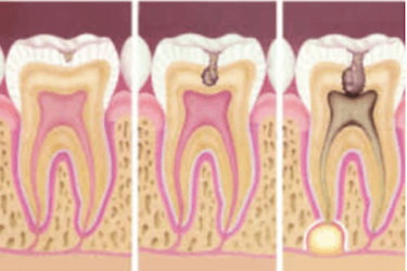 dolor de dientes y encias causas