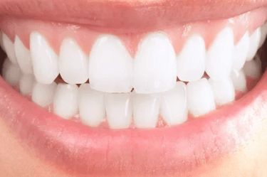 estetica dental madrid