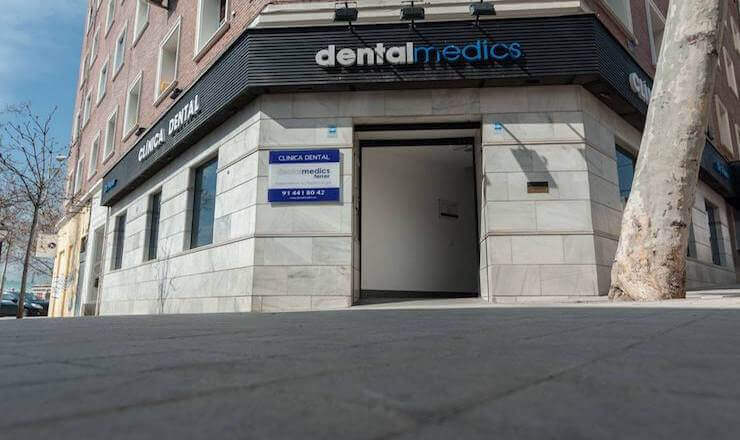 Precio de una Sobredentadura con 4 implantes dentales