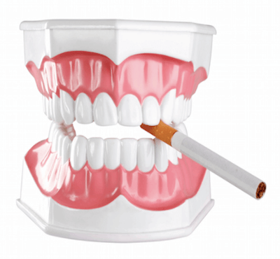  Implantes dentales y tabaco: tiempo sin fumar después de un implante - Clínica dental Dr. Ferrer | Madrid