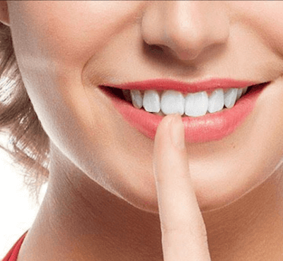  8 consejos para que tus carillas dentales duren más tiempo - Clínica dental Dr. Ferrer | Madrid