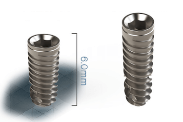 implantes dentales cortos