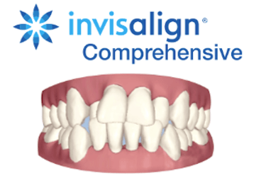 Invisalign Comprehensive