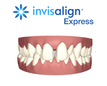 Invisalign express