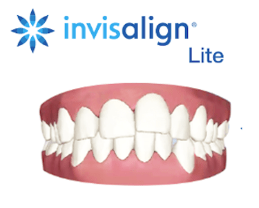 Invisalign Lite