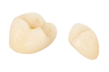 Fundas dentales de porcelana usadas en tratamientos en la Clínica Dental Dr. Ferrer en Murcia