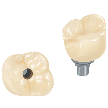 Corona de zirconio sobre implante dental con diseño atornillado
