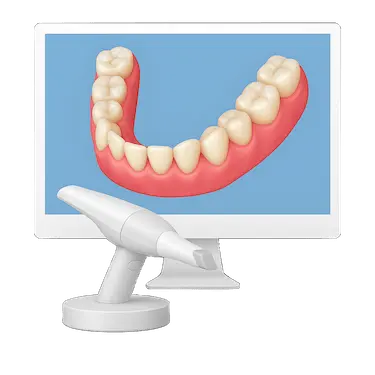 Escáner intraoral digital para tomar medidas de una corona sobre implante en arcada inferior