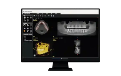 Monitor con imágenes 3D y radiografías de cirugía oral y maxilofacial en Madrid