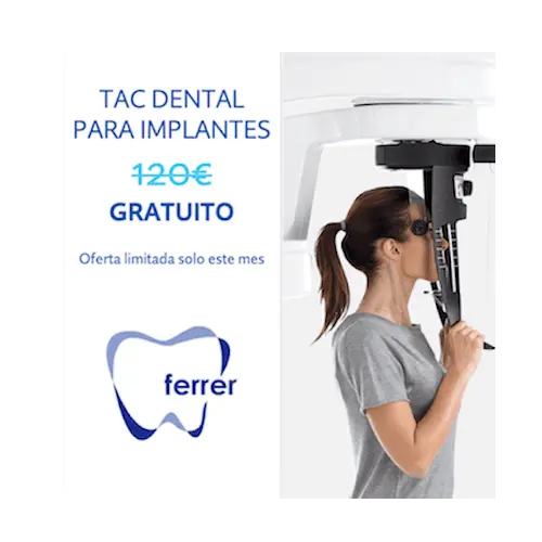 Oferta en Madrid: TAC dental gratuito para implantes en Clínica Dental Dr. Ferrer