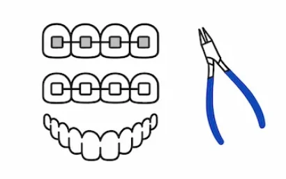 Tarifas de ortodoncia en la clínica dental del Dr. Ferrer